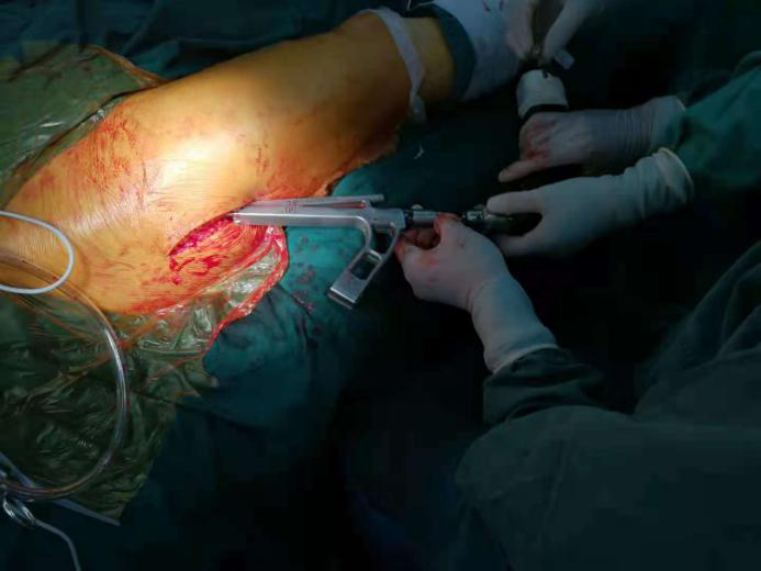 创伤骨科图片3-3.png 创伤骨科图片3-3.png