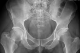 创伤骨科图片2-1.png 创伤骨科图片2-1.png