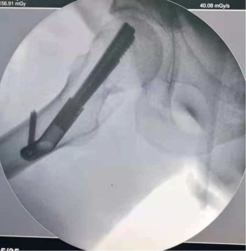 创伤骨科图片4-2.jpg 创伤骨科图片4-2.jpg