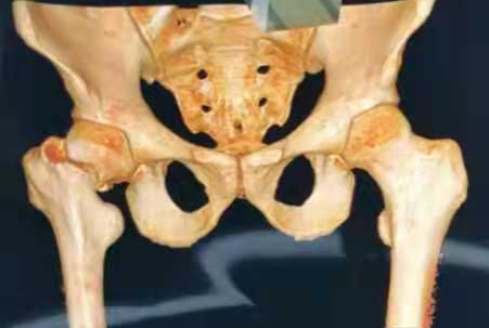 创伤骨科图片2-2.png 创伤骨科图片2-2.png