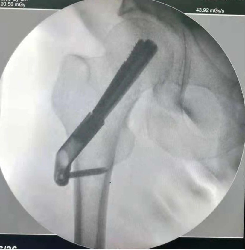 创伤骨科图片4-1.jpg 创伤骨科图片4-1.jpg