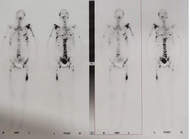 核医学科11.png 核医学科11.png