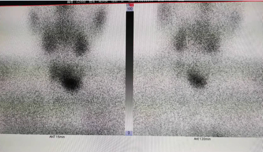 核医学科-图片1.png 核医学科-图片1.png