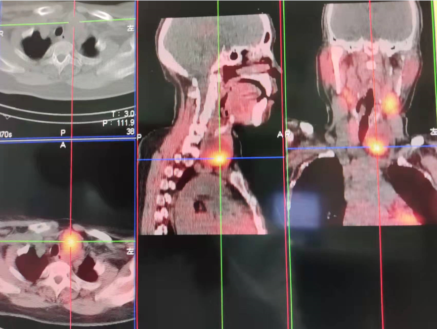 核医学科-图片2.png 核医学科-图片2.png