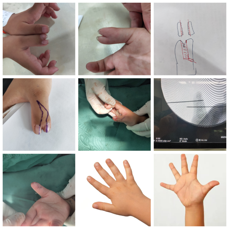 13394603450836539.png 13394603450836539.png