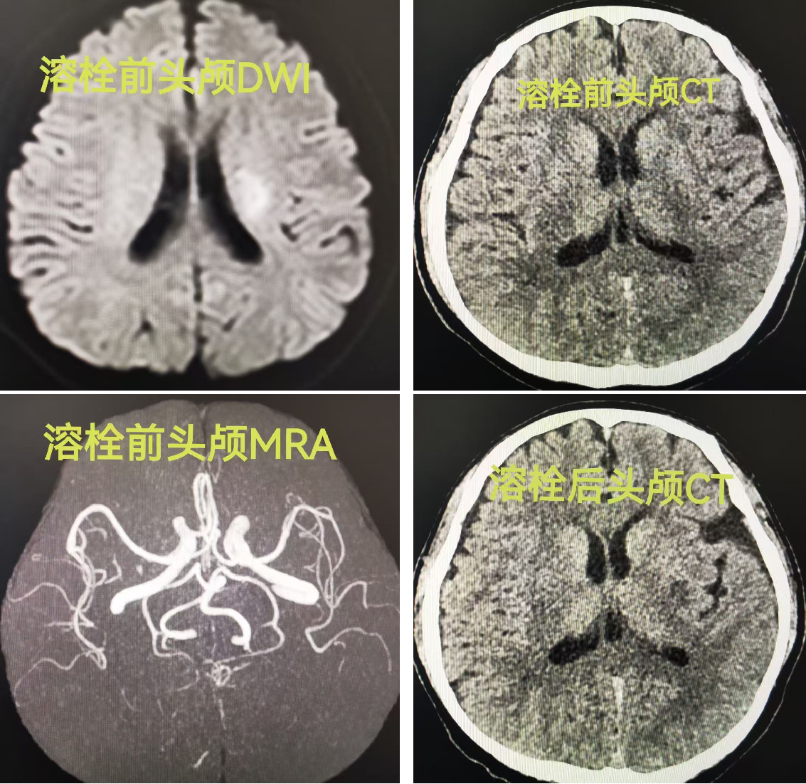 案例2.png 案例2.png